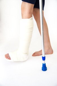 Huesos rotos - Fractura de hueso Diagnóstico y Recuperación Times