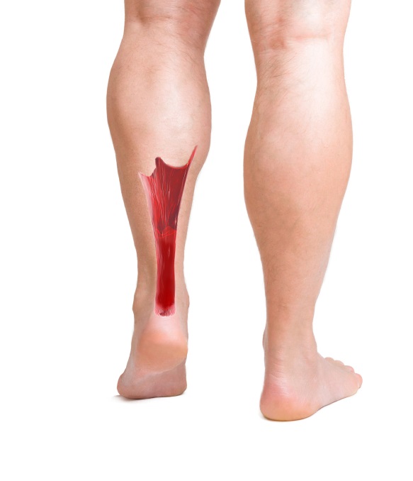 knee pain and achilles tendon