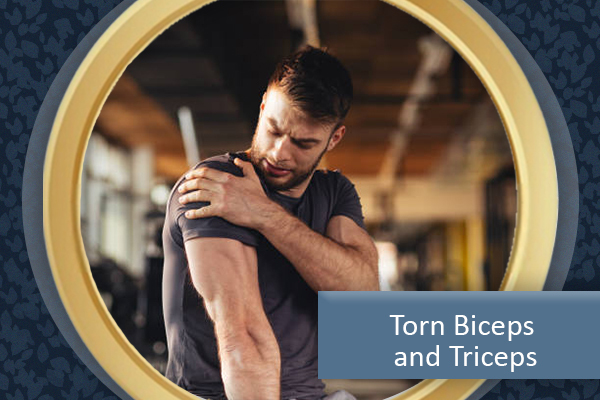 Triceps and Biceps - Onto Orthopedics