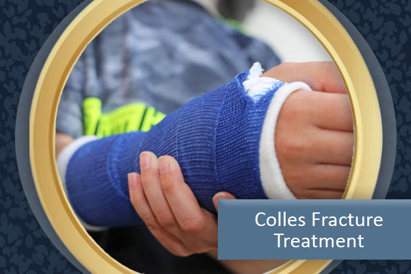 Colles Fracture: Symptoms, Causes & Treatment